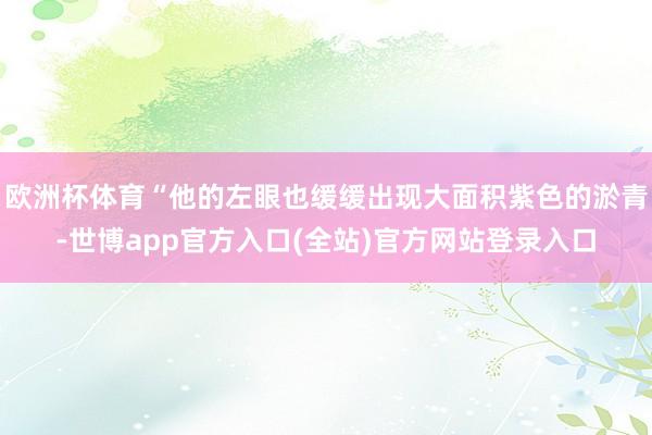 欧洲杯体育“他的左眼也缓缓出现大面积紫色的淤青-世博app官方入口(全站)官方网站登录入口
